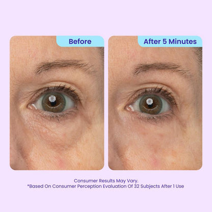 Liftique™ Instant Lift Eye Gel